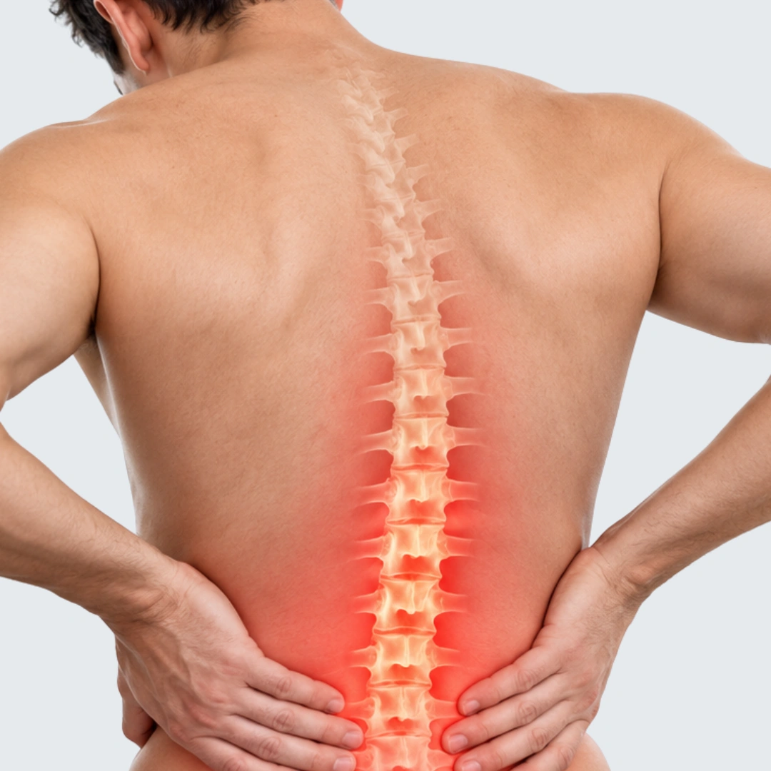 Ankylosing Spondylitis Treatment image 3